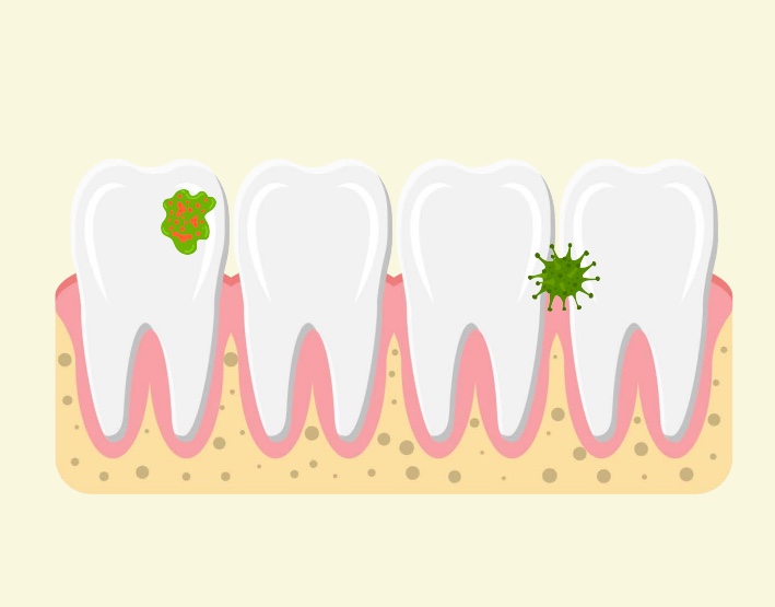 A cartoon representation of teeth with germs on them.